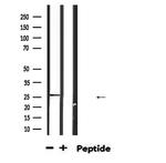 GADD45A Antibody in Western Blot (WB)