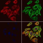 GABRA2 Polyclonal Antibody