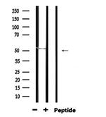 GABRA2 Antibody in Western Blot (WB)