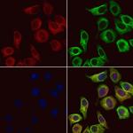 HSD3B2 Antibody in Immunocytochemistry (ICC/IF)