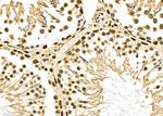 PTBP1 Antibody in Immunohistochemistry (Paraffin) (IHC (P))