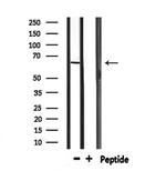 PTBP1 Antibody in Western Blot (WB)