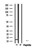 ROC1 Polyclonal Antibody