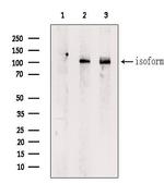 DST Antibody in Western Blot (WB)