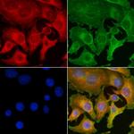 CDKN3 Polyclonal Antibody