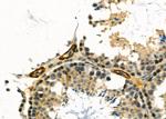 CDKN3 Antibody in Immunohistochemistry (Paraffin) (IHC (P))