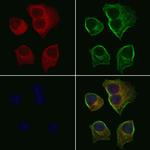 P2Y6 Polyclonal Antibody