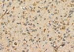 P2Y6 Antibody in Immunohistochemistry (Paraffin) (IHC (P))