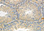 P2Y6 Antibody in Immunohistochemistry (Paraffin) (IHC (P))