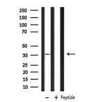 P2Y6 Antibody in Western Blot (WB)