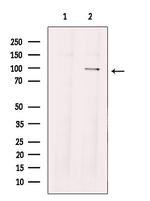 TTK Polyclonal Antibody
