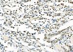 CD16 Polyclonal Antibody
