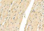 FBXO32 Polyclonal Antibody