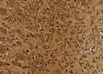 Cullin 4A Polyclonal Antibody