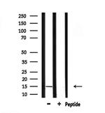 KISS1 Polyclonal Antibody
