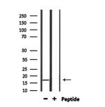 NDUFA13 Antibody in Western Blot (WB)