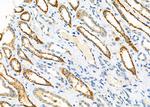 GARS Polyclonal Antibody