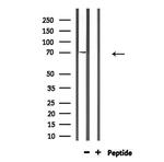 GARS Antibody in Western Blot (WB)