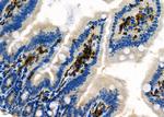 NQO2 Polyclonal Antibody