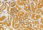 CBR1 Polyclonal Antibody