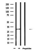CBR1 Antibody in Western Blot (WB)