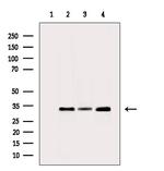 CBR1 Antibody in Western Blot (WB)