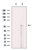 Cytokeratin 12 Polyclonal Antibody