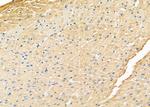 ZFYVE9 Antibody in Immunohistochemistry (Paraffin) (IHC (P))
