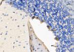 ZFYVE9 Polyclonal Antibody