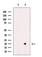 MRAP Polyclonal Antibody