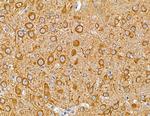 MAP1A Antibody in Immunohistochemistry (Paraffin) (IHC (P))