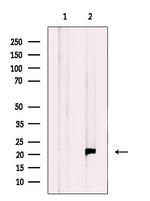 RT28 Polyclonal Antibody