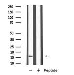 MRPL27 Antibody in Western Blot (WB)