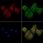 IMMP1L Polyclonal Antibody