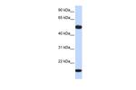 ADSSL1 Antibody in Western Blot (WB)