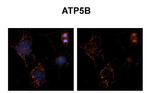 ATP Synthase beta Polyclonal Antibody