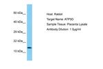 ATP5D Polyclonal Antibody