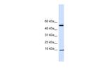 ATPIF1 Polyclonal Antibody