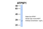 ATP Synthase B1 Antibody in Western Blot (WB)