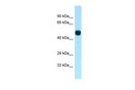 PFTK1 Polyclonal Antibody