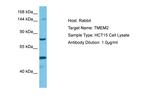 TMEM2 Antibody in Western Blot (WB)