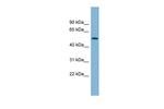 CNOT11 Polyclonal Antibody