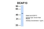 WDSOF1 Polyclonal Antibody