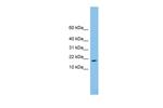 TAFA4 Polyclonal Antibody