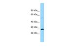 FTMT Polyclonal Antibody