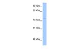 LIPT1 Polyclonal Antibody
