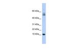 Myotrophin Polyclonal Antibody