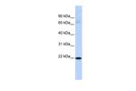 RBPMS2 Polyclonal Antibody