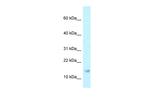 RPP21 Polyclonal Antibody