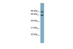 SLC12A8 Polyclonal Antibody